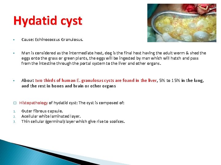 Hydatid cyst Cause: Echinococcus Granulosus. Man is considered as the intermediate host, dog is