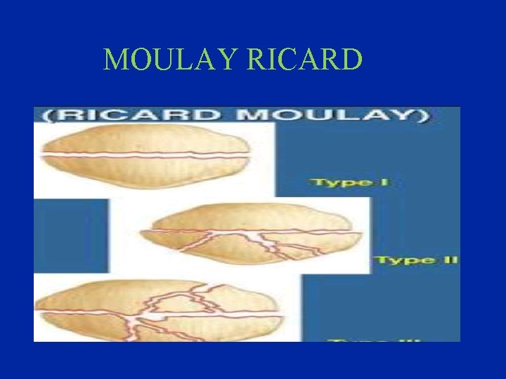 MOULAY RICARD 