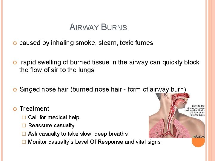 AIRWAY BURNS caused by inhaling smoke, steam, toxic fumes rapid swelling of burned tissue