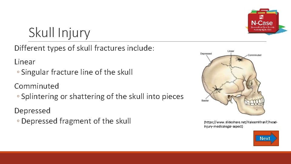 Skull Injury Different types of skull fractures include: Linear ◦ Singular fracture line of