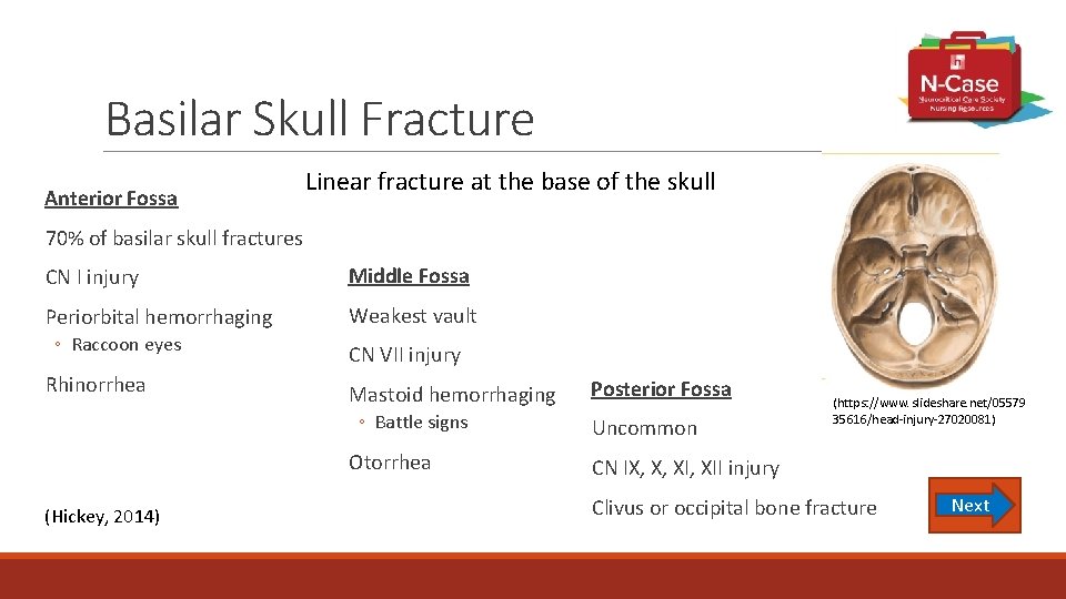 Basilar Skull Fracture Anterior Fossa Linear fracture at the base of the skull 70%