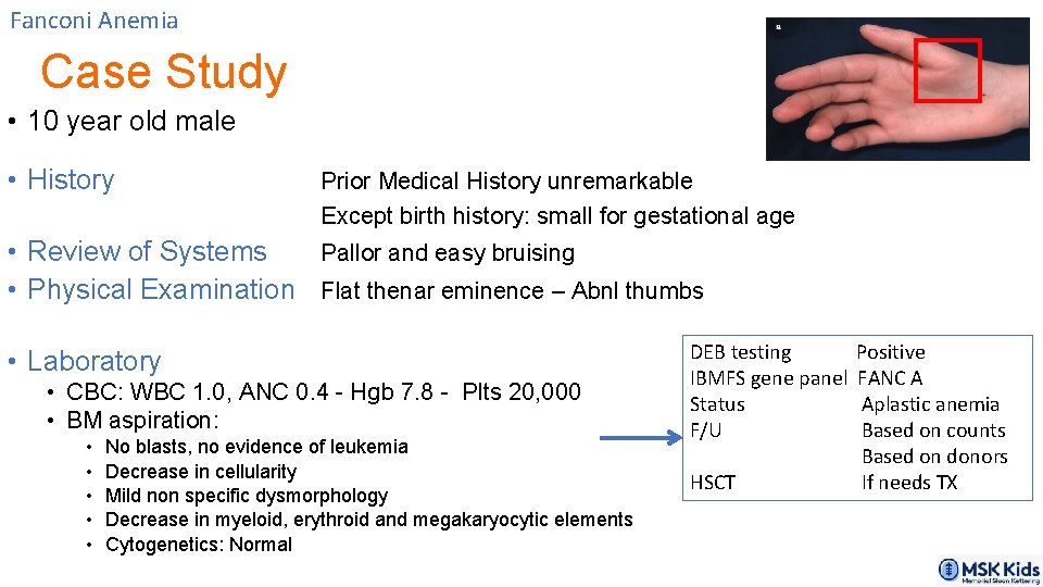 Fanconi Anemia Case Study • 10 year old male • History Prior Medical History