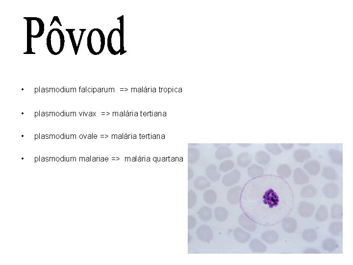  • plasmodium falciparum => malária tropica • plasmodium vivax => malária tertiana •