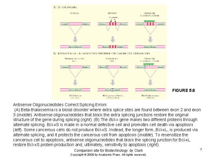 FIGURE 5. 6 Antisense Oligonucleotides Correct Splicing Errors (A) Beta-thalassemia is a blood disorder
