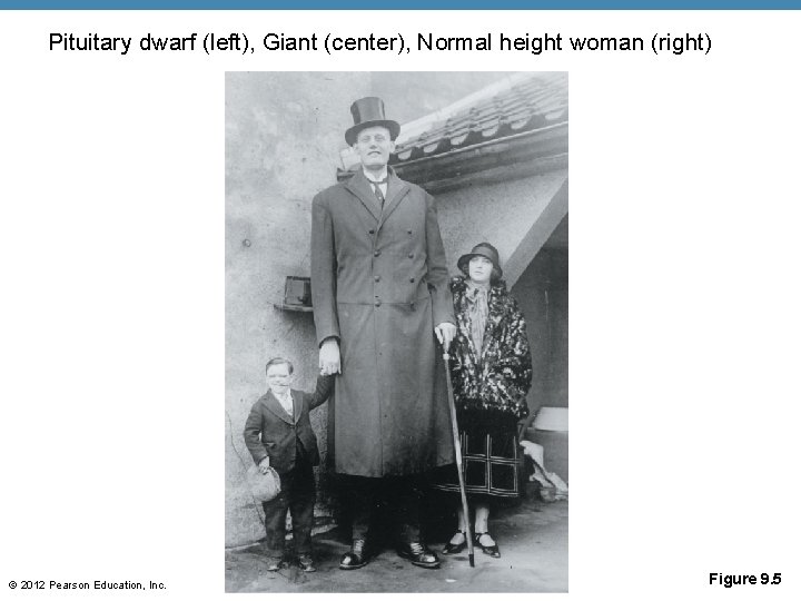 Pituitary dwarf (left), Giant (center), Normal height woman (right) © 2012 Pearson Education, Inc.