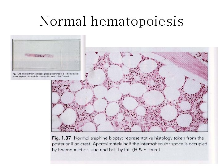 Normal hematopoiesis 