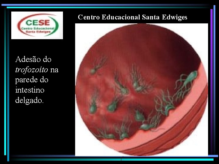 Centro Educacional Santa Edwiges Adesão do trofozoíto na parede do intestino delgado. 