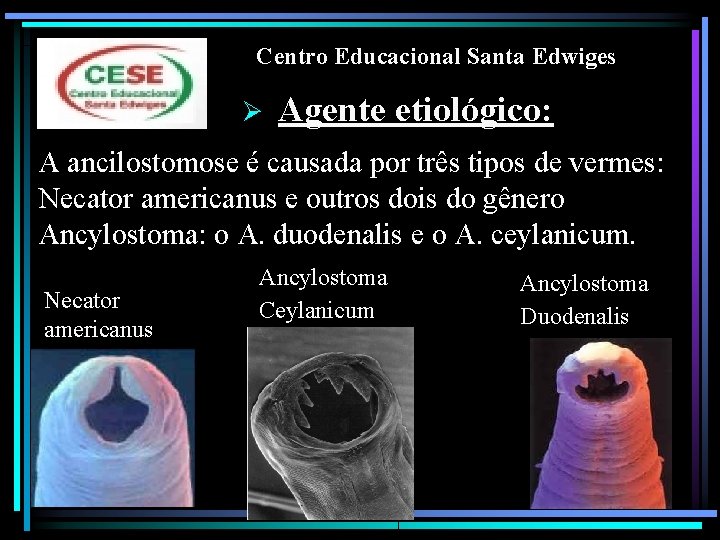 Centro Educacional Santa Edwiges Ø Agente etiológico: A ancilostomose é causada por três tipos