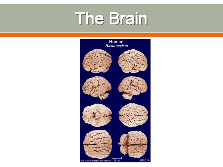 The Brain 