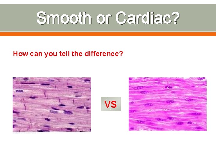 Smooth or Cardiac? How can you tell the difference? VS 