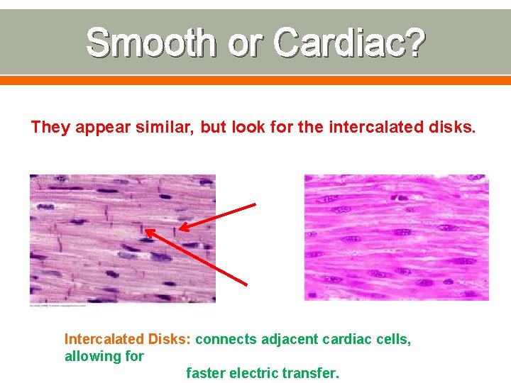 Smooth or Cardiac? They appear similar, but look for the intercalated disks. Intercalated Disks: