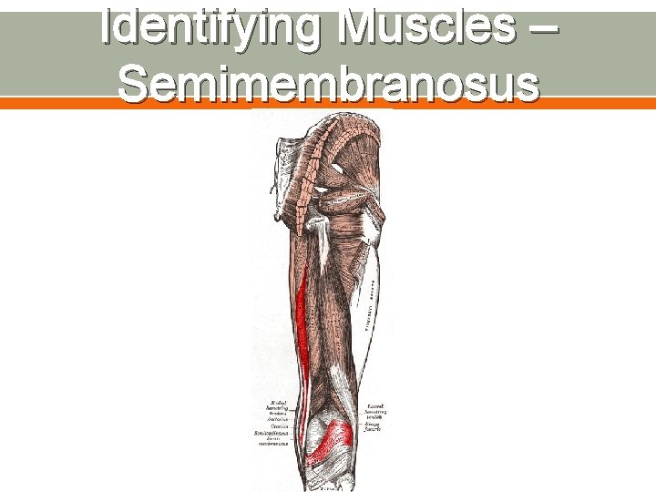 Identifying Muscles – Semimembranosus 