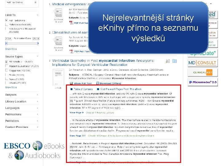 Nejrelevantnější stránky e. Knihy přímo na seznamu výsledků 