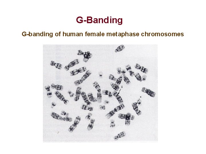 G-Banding G-banding of human female metaphase chromosomes 