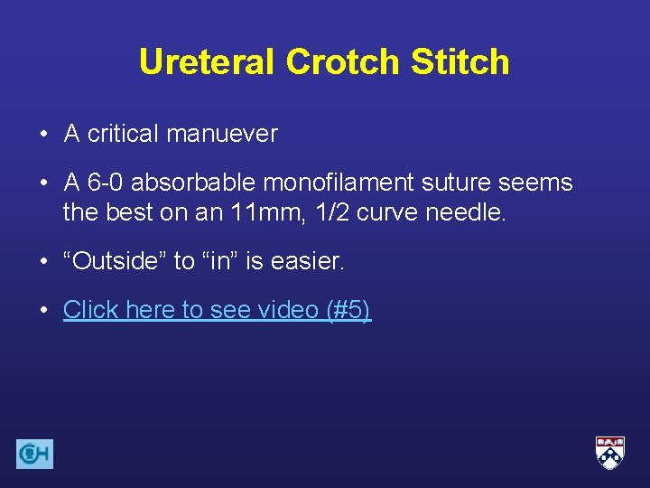 Ureteral Crotch Stitch • A critical manuever • A 6 -0 absorbable monofilament suture