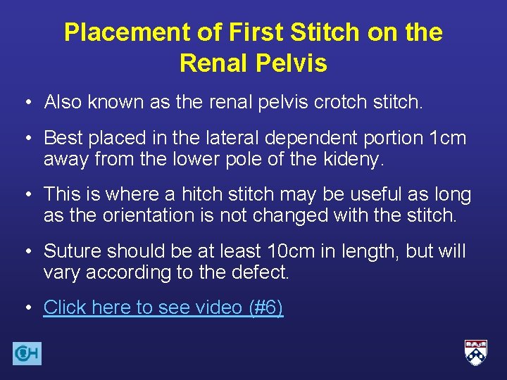 Placement of First Stitch on the Renal Pelvis • Also known as the renal