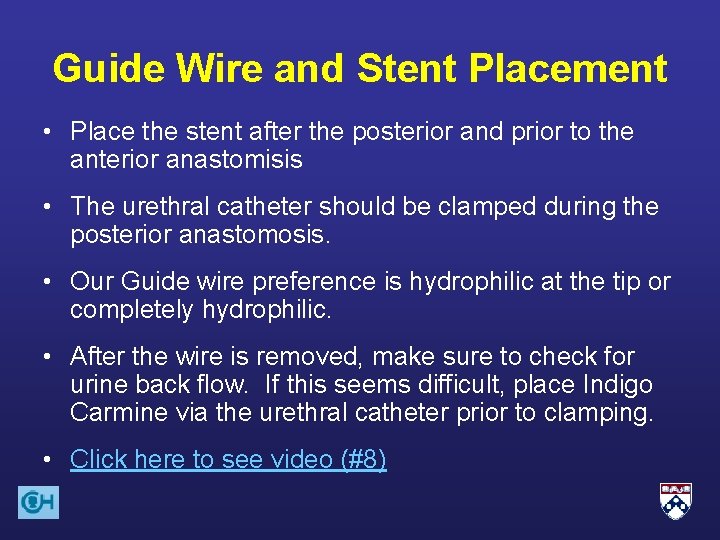 Guide Wire and Stent Placement • Place the stent after the posterior and prior