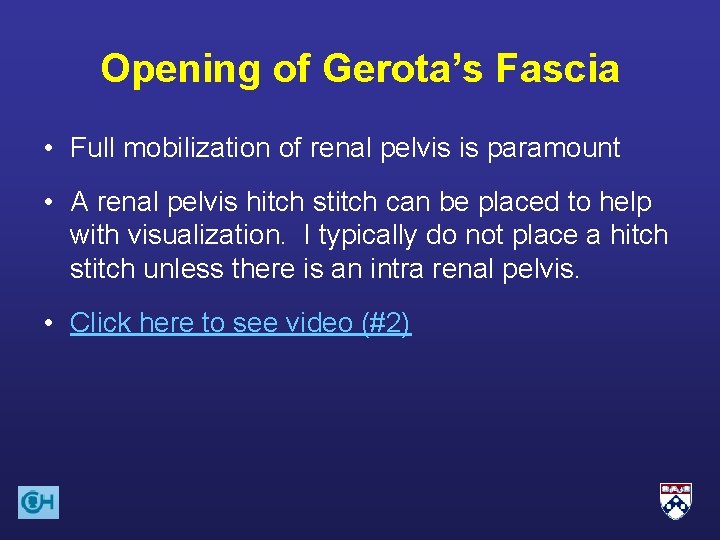 Opening of Gerota’s Fascia • Full mobilization of renal pelvis is paramount • A