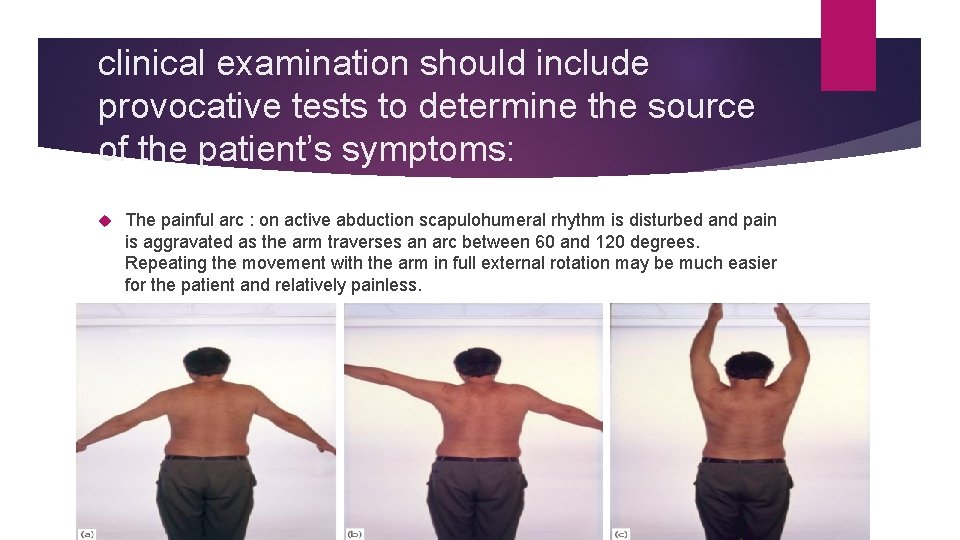 clinical examination should include provocative tests to determine the source of the patient’s symptoms: