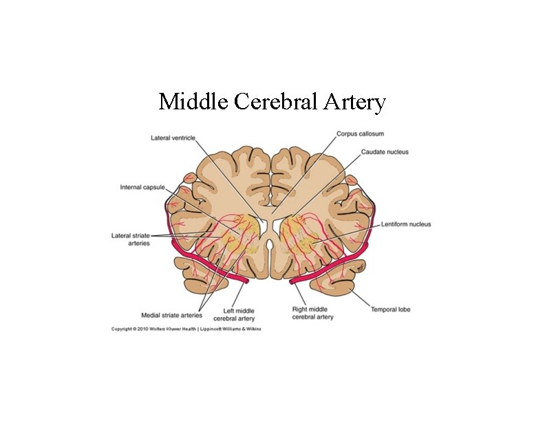 Middle Cerebral Artery 