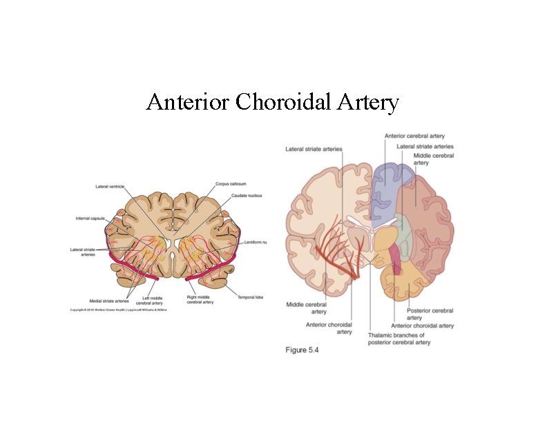 Anterior Choroidal Artery 