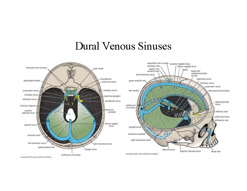 Dural Venous Sinuses 