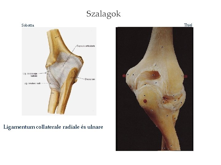 Szalagok Sobotta Ligamentum collaterale radiale és ulnare Thiel 