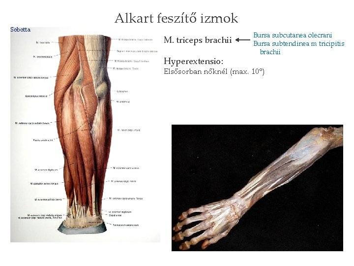 Sobotta Alkart feszítő izmok M. triceps brachii Hyperextensio: Bursa subcutanea olecrani Bursa subtendinea m