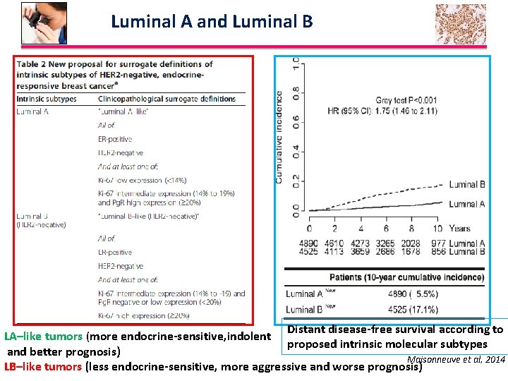 Luminal A and Luminal B Distant disease-free survival according to LA–like tumors (more endocrine-sensitive,