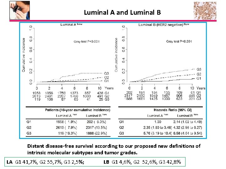 Luminal A and Luminal B Distant disease-free survival according to our proposed new definitions