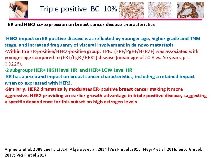 Triple positive BC 10% ER and HER 2 co-expression on breast cancer disease characteristics