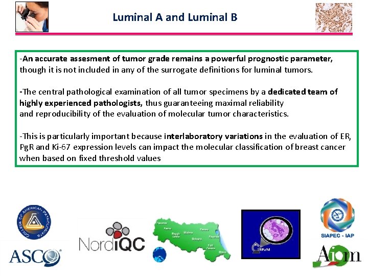 Luminal A and Luminal B -An accurate assesment of tumor grade remains a powerful
