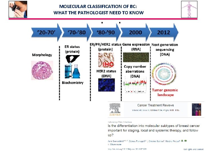 MOLECULAR CLASSIFICATION OF BC: WHAT THE PATHOLOGIST NEED TO KNOW 