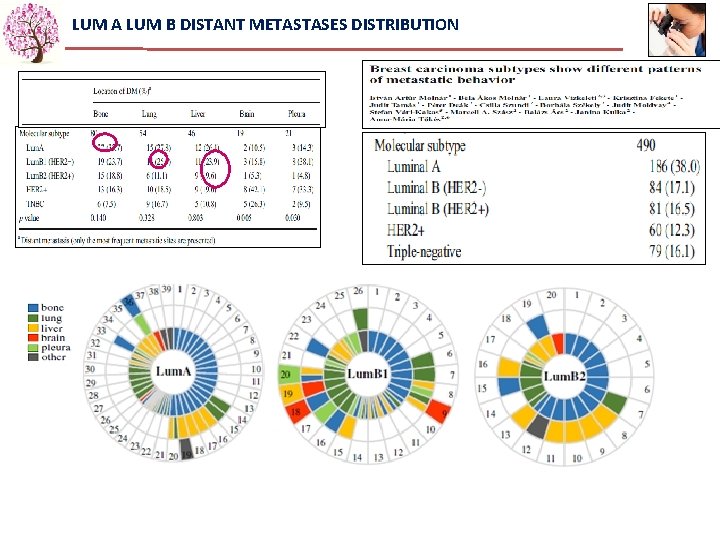 LUM A LUM B DISTANT METASTASES DISTRIBUTION 