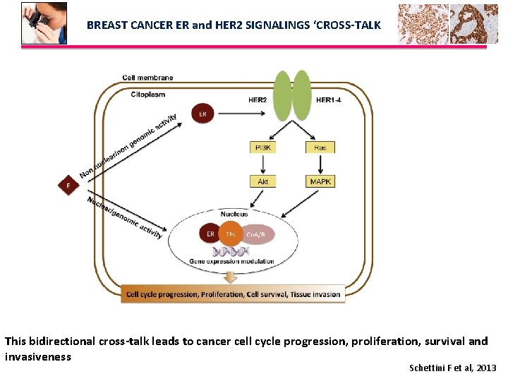 BREAST CANCER ER and HER 2 SIGNALINGS ‘CROSS-TALK This bidirectional cross-talk leads to cancer