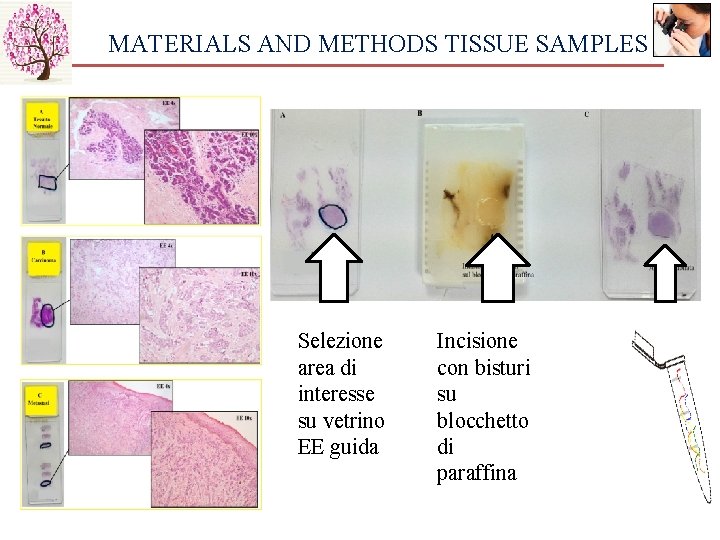 MATERIALS AND METHODS TISSUE SAMPLES Selezione area di interesse su vetrino EE guida Incisione