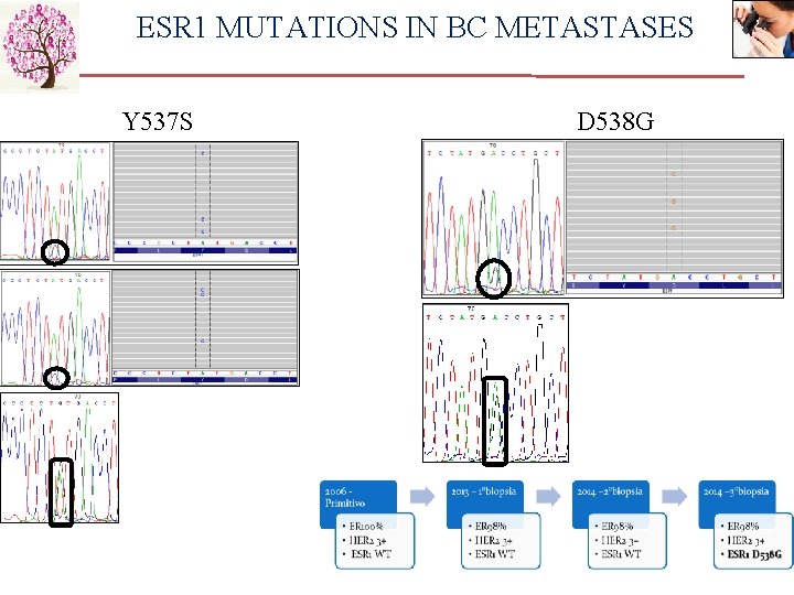ESR 1 MUTATIONS IN BC METASTASES Y 537 S D 538 G 