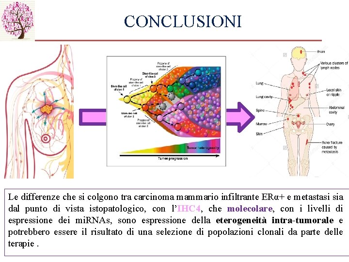 CONCLUSIONI Le differenze che si colgono tra carcinoma mammario infiltrante ERα+ e metastasi sia