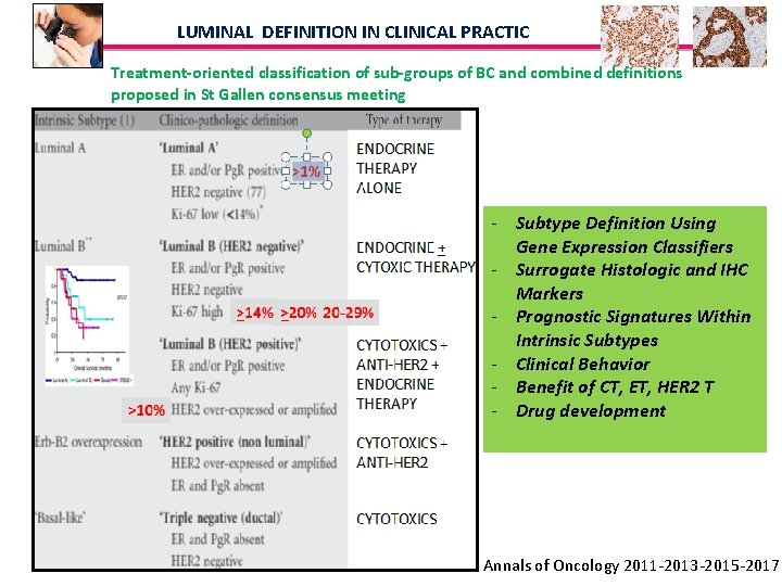 LUMINAL DEFINITION IN CLINICAL PRACTIC Treatment-oriented classification of sub-groups of BC and combined definitions