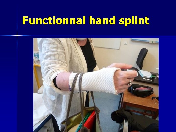  Functionnal hand splint 