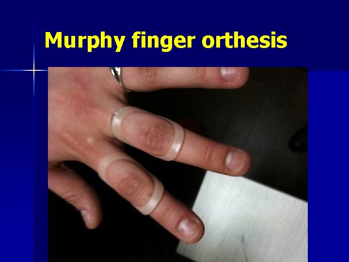 Murphy finger orthesis 