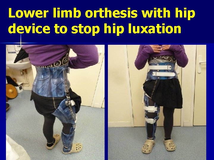 Lower limb orthesis with hip device to stop hip luxation 