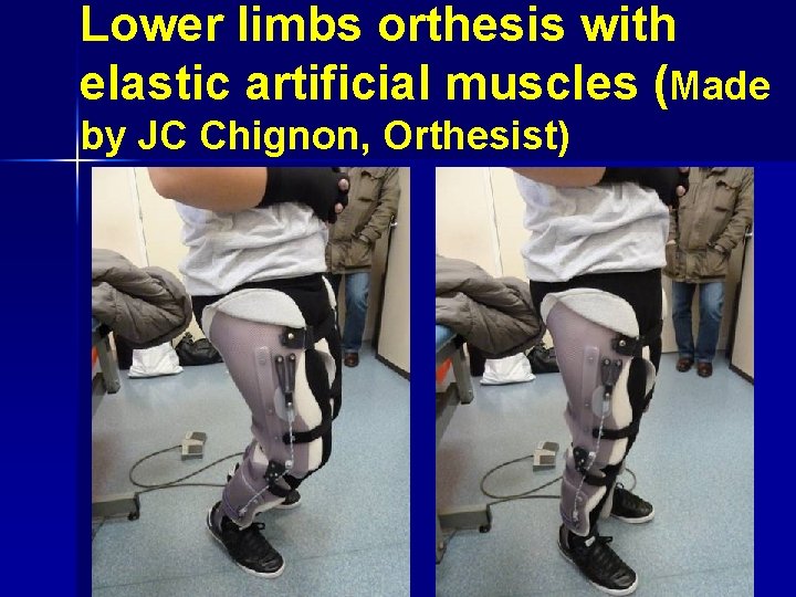 Lower limbs orthesis with elastic artificial muscles (Made by JC Chignon, Orthesist) 