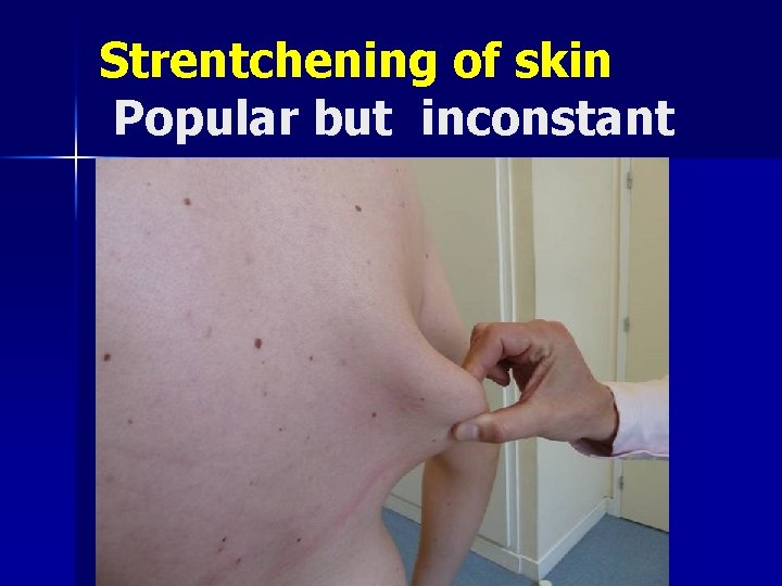 Strentchening of skin Popular but inconstant 