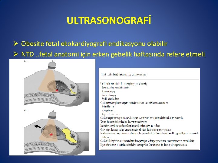 ULTRASONOGRAFİ Ø Obesite fetal ekokardiyografi endikasyonu olabilir Ø NTD. . fetal anatomi için erken