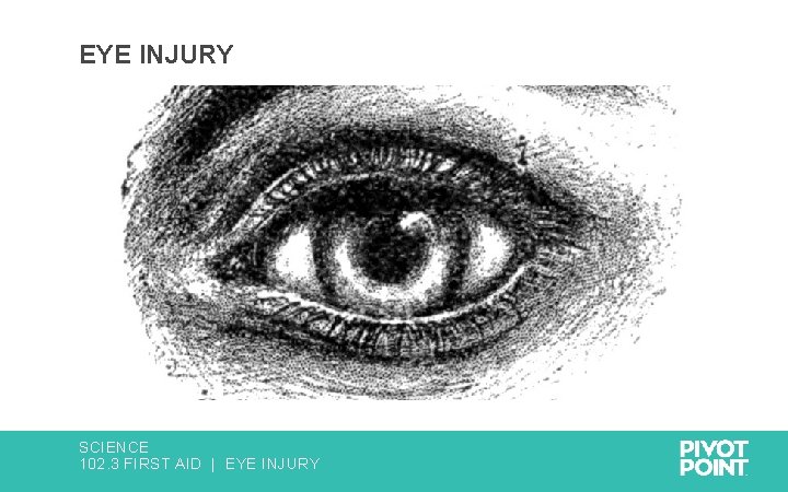 EYE INJURY SCIENCE 102. 3 FIRST AID | EYE INJURY 