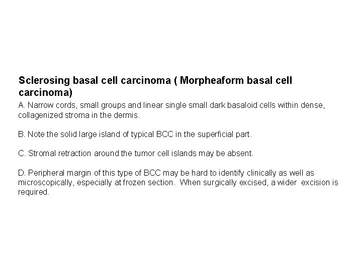 Sclerosing basal cell carcinoma ( Morpheaform basal cell carcinoma) A. Narrow cords, small groups