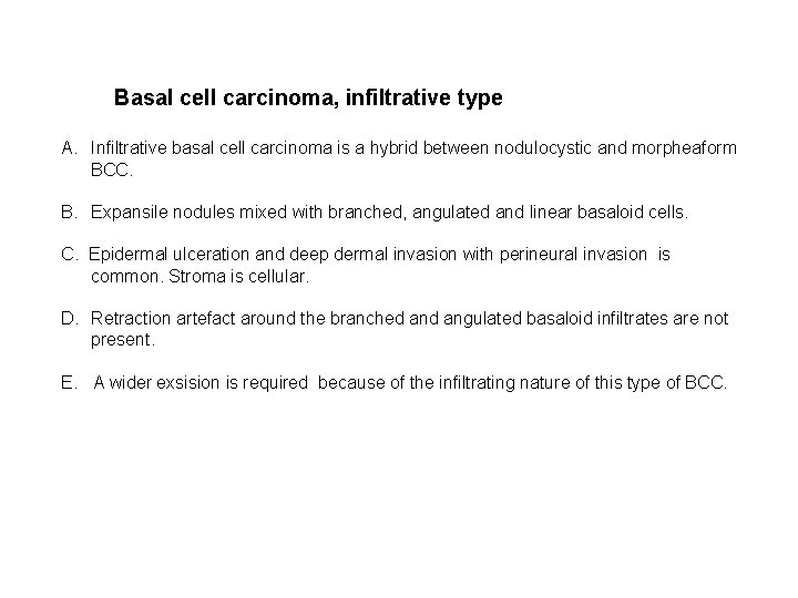 Basal cell carcinoma, infiltrative type A. Infiltrative basal cell carcinoma is a hybrid between