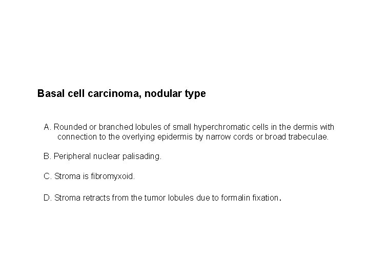Basal cell carcinoma, nodular type A. Rounded or branched lobules of small hyperchromatic cells