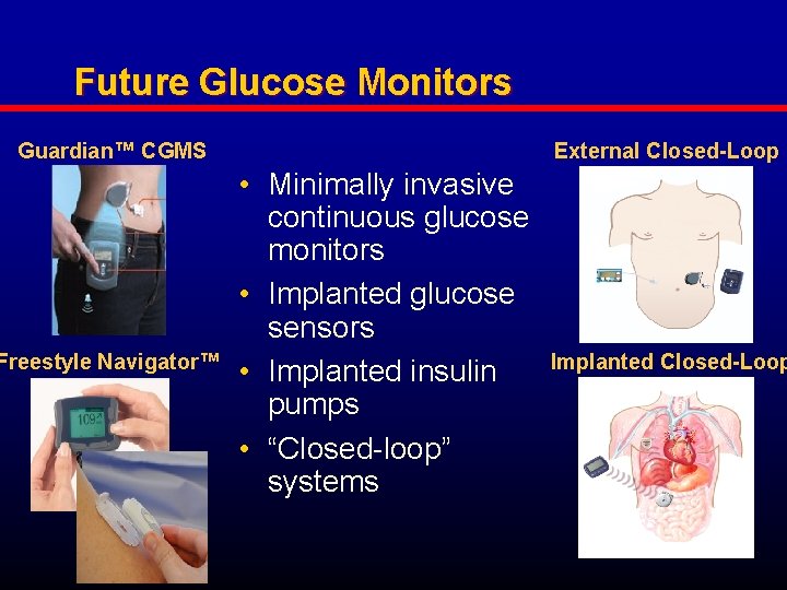Future Glucose Monitors Guardian™ CGMS Freestyle Navigator™ External Closed-Loop • Minimally invasive continuous glucose